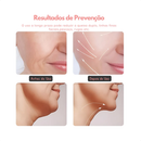 Aparelho Tratamento Massageador Facial Led Lift Fototerapia